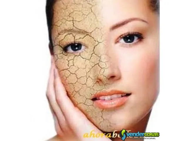 Aceite de argan anti edad antiestrias mejora acne 3