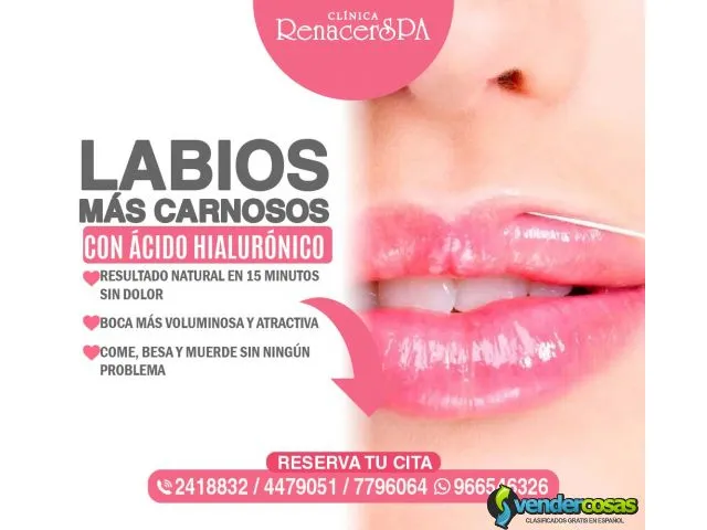 ácido hialurónico labios mas redondos 1