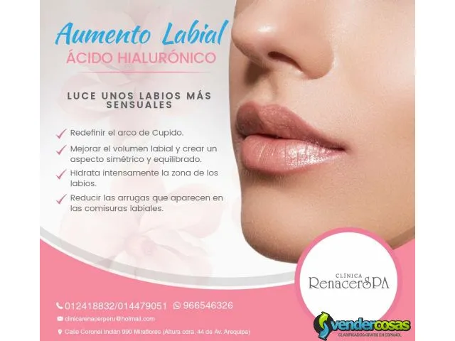 Aumento de labios con ácido hialurónico 1