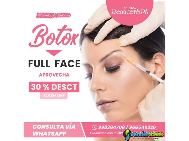 Botox full face 1