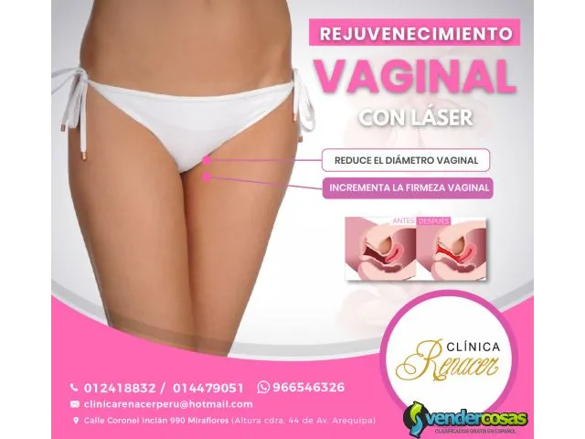 Cambia el aspecto vaginal - clínica renacer 1