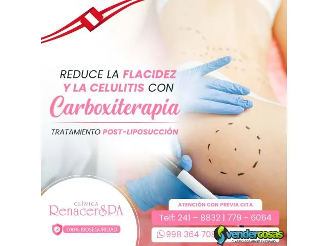Carboxiterapia: reduces cellulitis 1