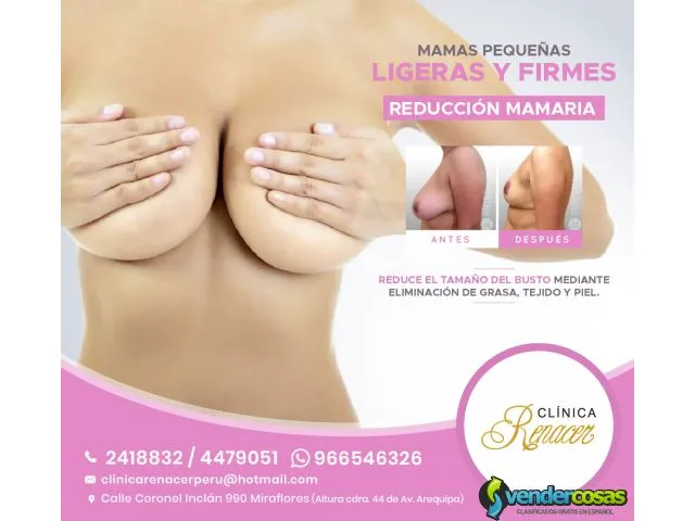 Cirugía de reducción de mamas - clínica renacer 2
