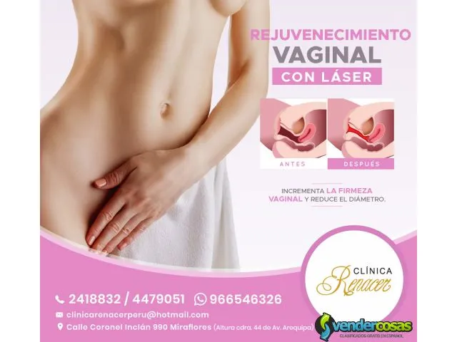 Cirugía vaginal láser - clínica renacer 1