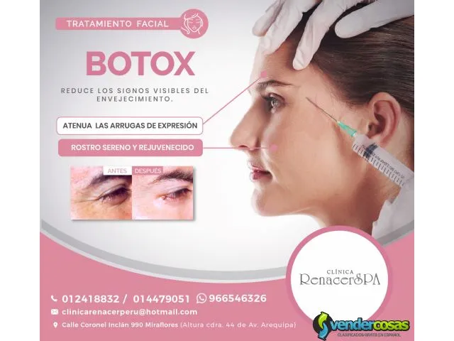 Corrige arrugas con botox - clínica renacerspa 1