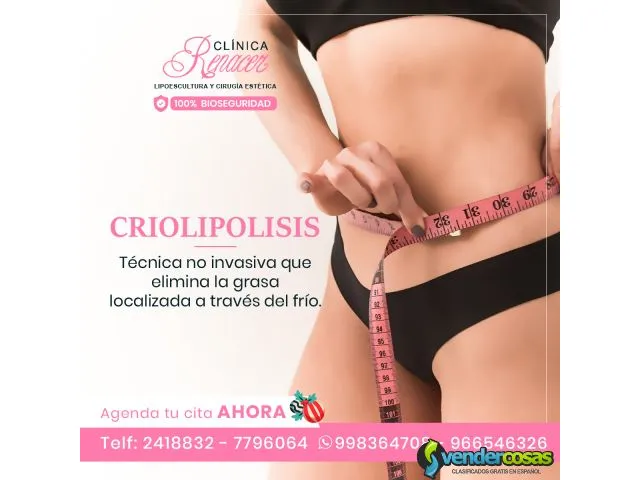 Elimina la grasa con criolipolisis. 1