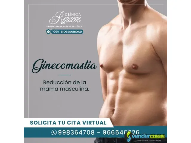 Ginecomastia. 1