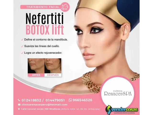 Nefertiti botox lift- la clínica renacerspa 1