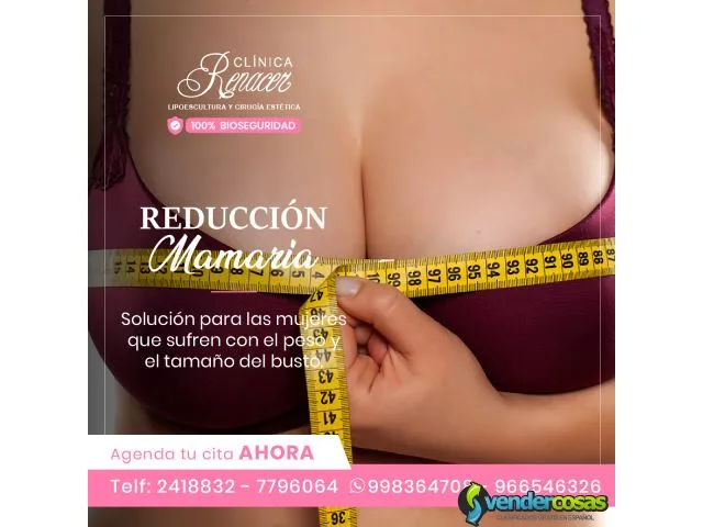 Reducción de mamas. 1