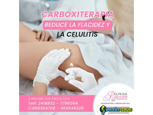 Reduce la celulitis con carboxiterapia  1