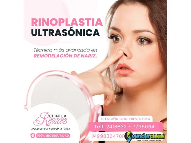 Rinoplastia ultrasónica 1
